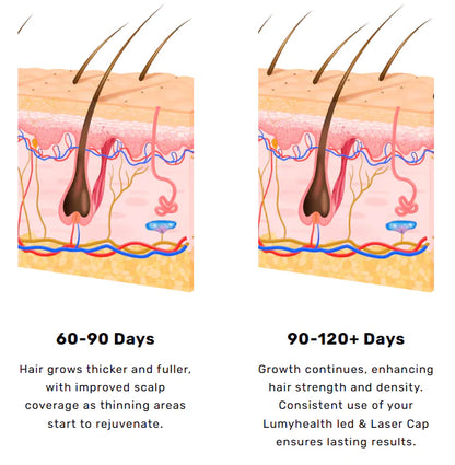 LLLT Red Light Therapy Hair Growth Cap